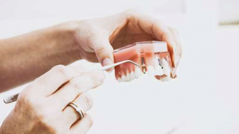 Are titanium dental implants safe?